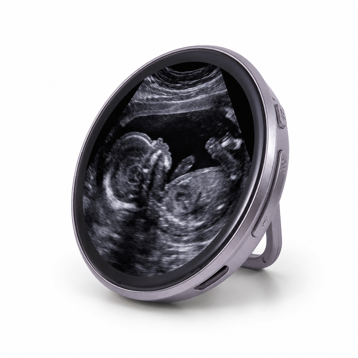 LoveLoop™ - The cutest keepsake of your baby’s ultrasound