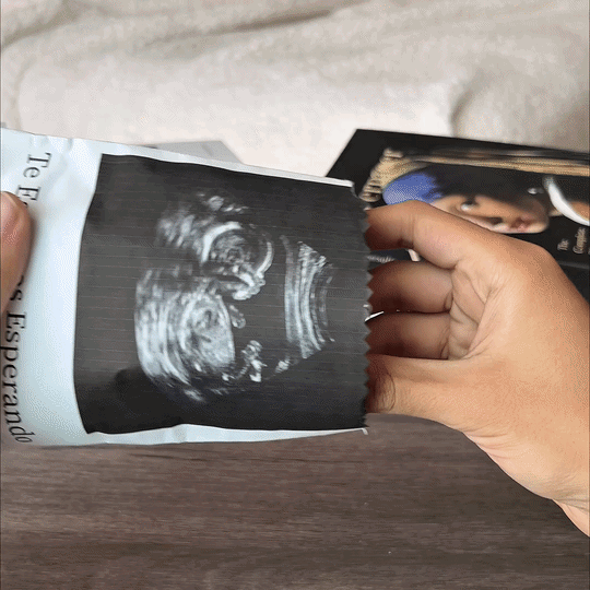 LoveLoop™ - The cutest keepsake of your baby’s ultrasound